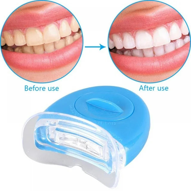 Teeth Whitening Tool Dental Bleaching System Oral Gel Kit Tooth Whitener Dental Equipment