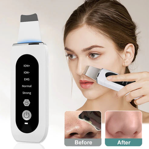 Ultrasonic Skin Scrubber – Deep Pore Cleansing & Blackhead Remover Device
